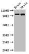 Vacuolar adenosine triphosphatase subunit Ac116 antibody, CSB-PA846292LA01HU, Cusabio, Western Blot image 