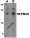 Laforin antibody, 7023, ProSci Inc, Western Blot image 