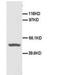 CD40 Molecule antibody, AP23319PU-N, Origene, Western Blot image 