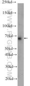 Ankyrin Repeat And LEM Domain Containing 1 antibody, 24080-1-AP, Proteintech Group, Western Blot image 
