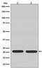 Ras antibody, M00099-2, Boster Biological Technology, Western Blot image 