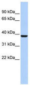 Aminolevulinate Dehydratase antibody, TA346146, Origene, Western Blot image 