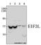 Eukaryotic Translation Initiation Factor 3 Subunit L antibody, A02238-1, Boster Biological Technology, Western Blot image 