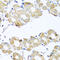 Coenzyme Q7, Hydroxylase antibody, 23-170, ProSci, Immunohistochemistry paraffin image 