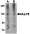 NLR Family Pyrin Domain Containing 5 antibody, A08138, Boster Biological Technology, Western Blot image 