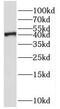 SH3 Domain Containing GRB2 Like 3, Endophilin A3 antibody, FNab07834, FineTest, Western Blot image 