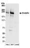 Zinc Finger FYVE-Type Containing 16 antibody, A304-575A, Bethyl Labs, Western Blot image 