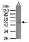 Acyl-CoA Dehydrogenase Short Chain antibody, PA5-34639, Invitrogen Antibodies, Western Blot image 