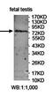 F-Box And Leucine Rich Repeat Protein 5 antibody, orb78428, Biorbyt, Western Blot image 