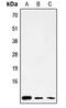 Mitochondrially Encoded ATP Synthase Membrane Subunit 8 antibody, MBS822281, MyBioSource, Western Blot image 