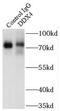 DEAD-Box Helicase 4 antibody, FNab02308, FineTest, Immunoprecipitation image 