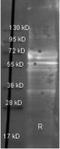 Fibrinogen Alpha Chain antibody, TA319310, Origene, Western Blot image 