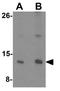 Centromere Protein W antibody, GTX31488, GeneTex, Western Blot image 