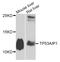 Tumor Protein P53 Regulated Apoptosis Inducing Protein 1 antibody, A7224, ABclonal Technology, Western Blot image 