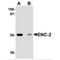 Kelch Like Family Member 25 antibody, MBS150793, MyBioSource, Western Blot image 