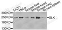 STE20 Like Kinase antibody, A7213, ABclonal Technology, Western Blot image 
