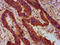 Monoacylglycerol O-Acyltransferase 1 antibody, LS-C682304, Lifespan Biosciences, Immunohistochemistry paraffin image 