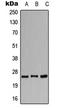 Calcium Voltage-Gated Channel Auxiliary Subunit Gamma 1 antibody, LS-C351895, Lifespan Biosciences, Western Blot image 