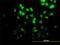 Diphthamide Biosynthesis 2 antibody, H00001802-M02, Novus Biologicals, Immunofluorescence image 