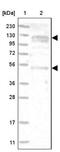 Ankyrin Repeat And FYVE Domain Containing 1 antibody, NBP1-89085, Novus Biologicals, Western Blot image 