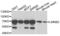 Laminin Subunit Beta 2 antibody, LS-C334748, Lifespan Biosciences, Western Blot image 