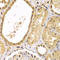 X-Linked Inhibitor Of Apoptosis antibody, LS-C346128, Lifespan Biosciences, Immunohistochemistry paraffin image 