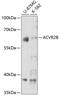 ACTR-IIB antibody, 23-239, ProSci, Western Blot image 