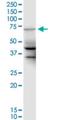 Putative ubiquitin-conjugating enzyme E2 D2-like protein antibody, H00340561-M01, Novus Biologicals, Western Blot image 