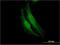 Fanconi anemia group F protein antibody, H00002188-M03, Novus Biologicals, Immunofluorescence image 