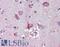 Nodal Growth Differentiation Factor antibody, LS-B3955, Lifespan Biosciences, Immunohistochemistry paraffin image 