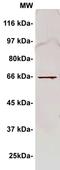 Protein LYRIC antibody, TA354927, Origene, Western Blot image 