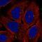 Adenylate Cyclase 7 antibody, NBP2-58945, Novus Biologicals, Immunofluorescence image 
