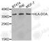 Major Histocompatibility Complex, Class II, DO Alpha antibody, A6923, ABclonal Technology, Western Blot image 