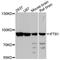 Intraflagellar Transport 81 antibody, A4662, ABclonal Technology, Western Blot image 