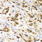 Melanoma-associated antigen 1 antibody, A03570-1, Boster Biological Technology, Immunohistochemistry frozen image 