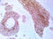 ERBB2 antibody, LS-C796708, Lifespan Biosciences, Immunohistochemistry frozen image 