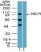 NLR Family Pyrin Domain Containing 9 antibody, NBP2-24661, Novus Biologicals, Western Blot image 