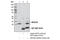 BRCA1/BRCA2-Containing Complex Subunit 3 antibody, 18215S, Cell Signaling Technology, Immunoprecipitation image 
