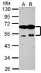 Zinc finger FYVE domain-containing protein 19 antibody, PA5-30855, Invitrogen Antibodies, Western Blot image 