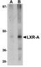 Nuclear Receptor Subfamily 1 Group H Member 3 antibody, TA306911, Origene, Western Blot image 
