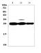 Mannose Binding Lectin 2 antibody, A01000-2, Boster Biological Technology, Western Blot image 