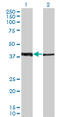 Zinc Finger And SCAN Domain Containing 26 antibody, LS-C198491, Lifespan Biosciences, Western Blot image 