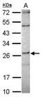Deleted In Primary Ciliary Dyskinesia Homolog (Mouse) antibody, GTX119808, GeneTex, Western Blot image 