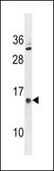 Putative polypeptide N-acetylgalactosaminyltransferase-like protein 5 antibody, LS-C157761, Lifespan Biosciences, Western Blot image 