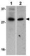 Baculoviral IAP Repeat Containing 8 antibody, GTX31666, GeneTex, Western Blot image 