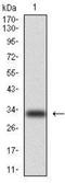 Keratin 5 antibody, NBP2-22194, Novus Biologicals, Western Blot image 