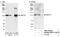 Zinc Finger Protein 777 antibody, NBP1-03344, Novus Biologicals, Western Blot image 