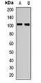 Plasminogen antibody, LS-C668619, Lifespan Biosciences, Western Blot image 