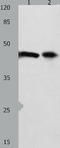Forkhead Box L1 antibody, TA322642, Origene, Western Blot image 