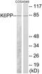 Phosphofructokinase, Platelet antibody, EKC1768, Boster Biological Technology, Western Blot image 